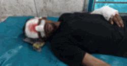 কোটালীপাড়ায়  স্বাস্থ্যকমপ্লেক্সে ঢুকে রোগীকে কুপিয়ে আহতের অভিযোগ