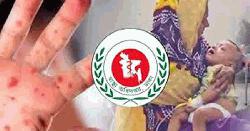 দেশে হাম ও উপসর্গে আরও ৫ শিশুর মৃত্যু