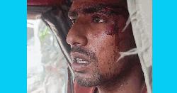 হত্যাচেষ্টা মামলা ভিন্ন খাতে নেওয়ার অভিযোগ, ভুক্তভোগী পরিবারের দাবি