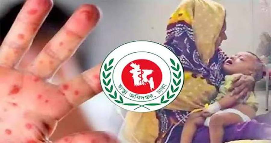 দেশজুড়ে গত ২৪ ঘণ্টায় হাম উপসর্গে ৭ জনের মৃত্যু