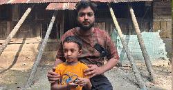 দুই হিপ নষ্ট হয়ে শয্যাশায়ী আনোয়ার: বাঁচতে চান অবুঝ শিশুর পিতা