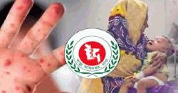 দেশে হাম উপসর্গে আরও ৭ শিশুর মৃত্যু