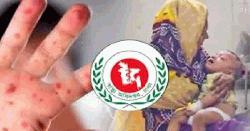 হামের উপসর্গ নিয়ে আরও ৮ জনের মৃত্যু